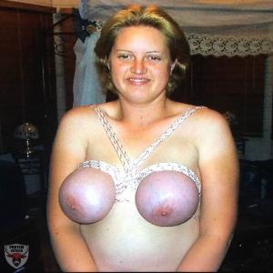 Jacqui Thorn Purple Tits