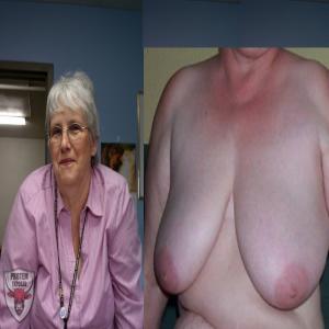 Edith Foote for exposing